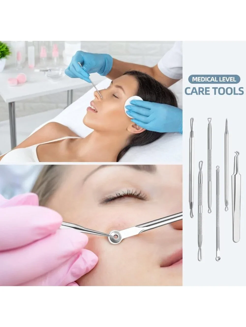 Effective Blackhead Remover Kit | Comedone Extractor for Acne Treatment & Clear